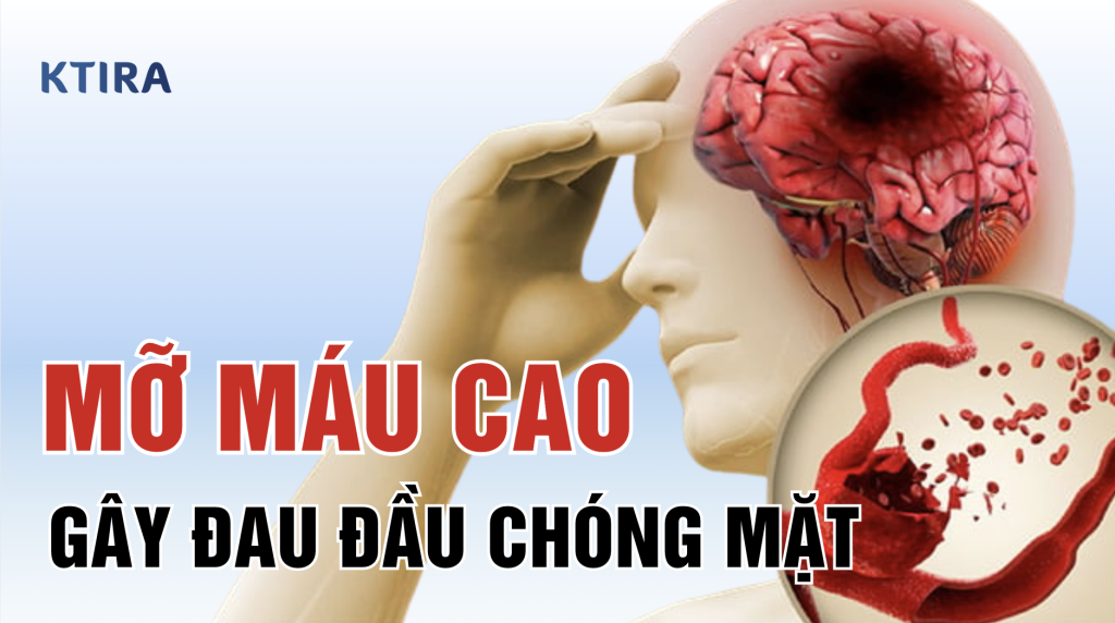 mo mau cao gay dau dau chong mat