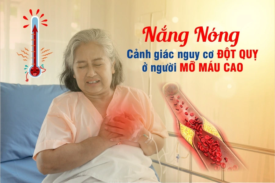 nang nong lam tang nguy co dot quy o nguoi mo mau cao
